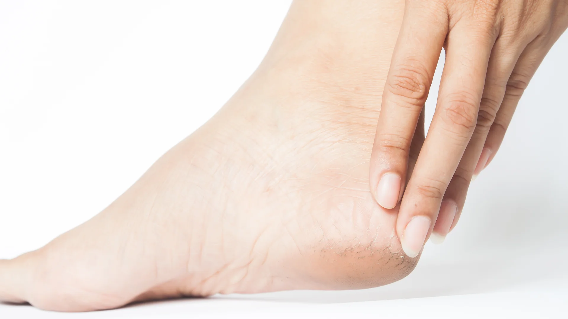 Topuk Dikeni Nedir? 